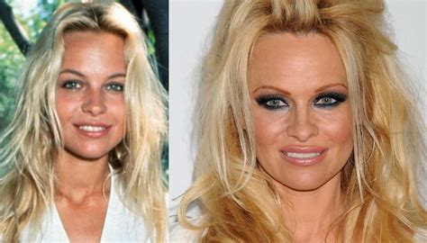 pamela anderson silicone|From supersized to a more natural look: The evolution of breast。